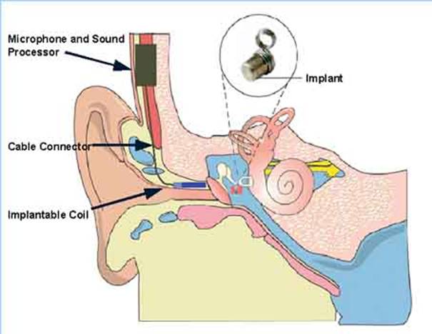 Biomechanics Of The Tympanic Membrane